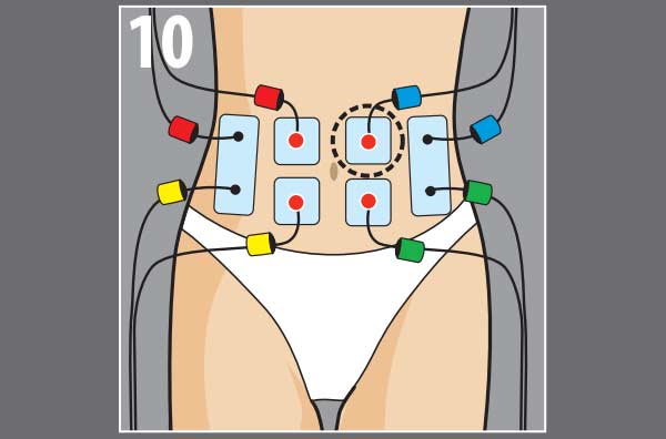 Схема расположения электродов на животе Схема расположения электродов на животе