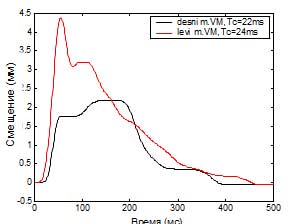 Система диагностики мышц