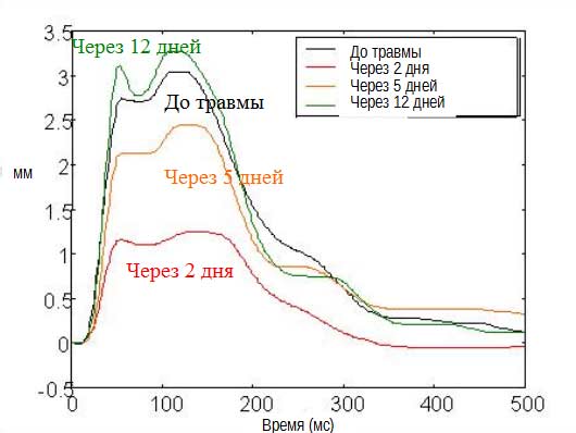 Система диагностики мышц