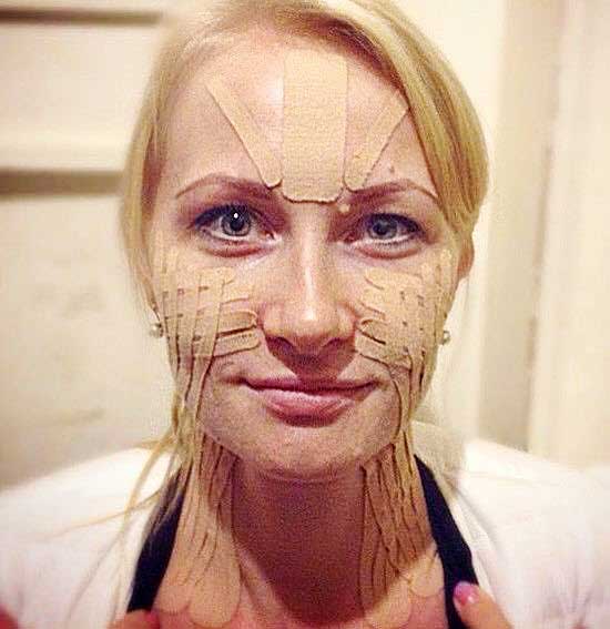 Кинесио тейпинг в косметологии