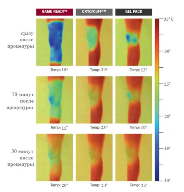 Компрессионно-холодовая терапия Game Ready