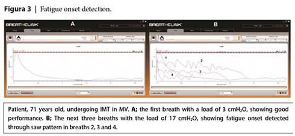 Тренировки мышц вдоха с помощью POWERbreathe у пациентов с искусственной вентиляцией легких