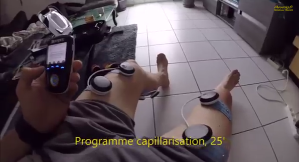 Программа капилляризации с электростимулятором Compex (видео)